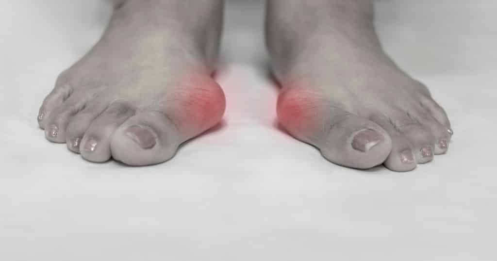 3-Simple-Foot-Exercises-to-help-people-with-Bunions-feature-image