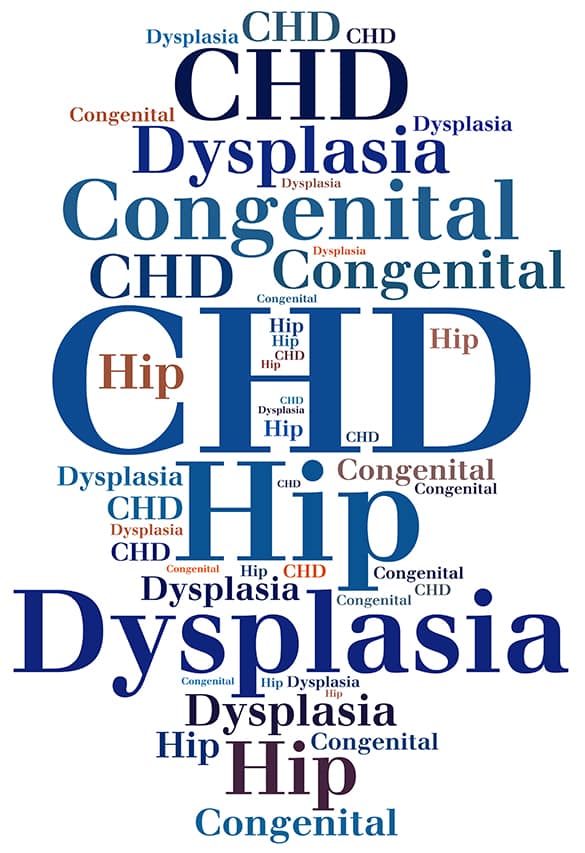 CHD-Congenital-Hip-Dysplasia