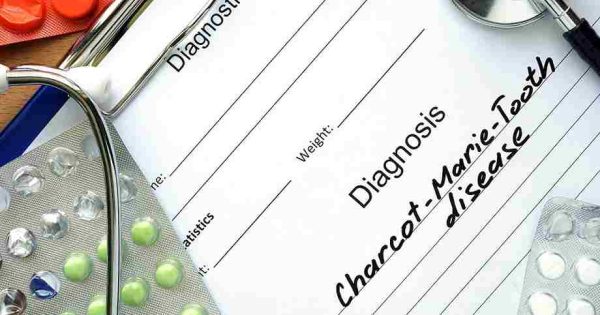 Can The Richie Brace Help Charcot Marie Tooth Disease