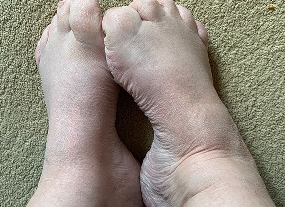 Charcot-5 Charcot-5