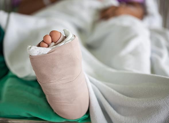 Foot-splint-patient