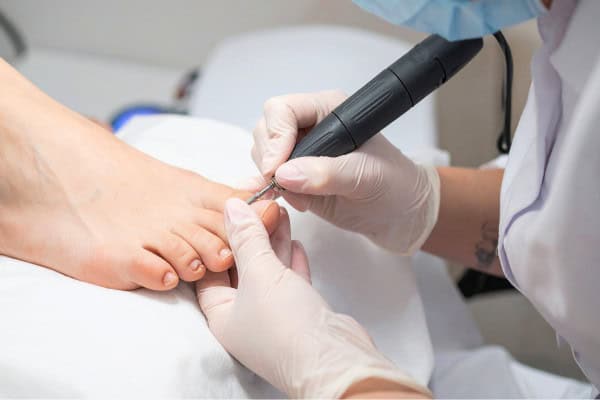 General Foot and Toenail Care