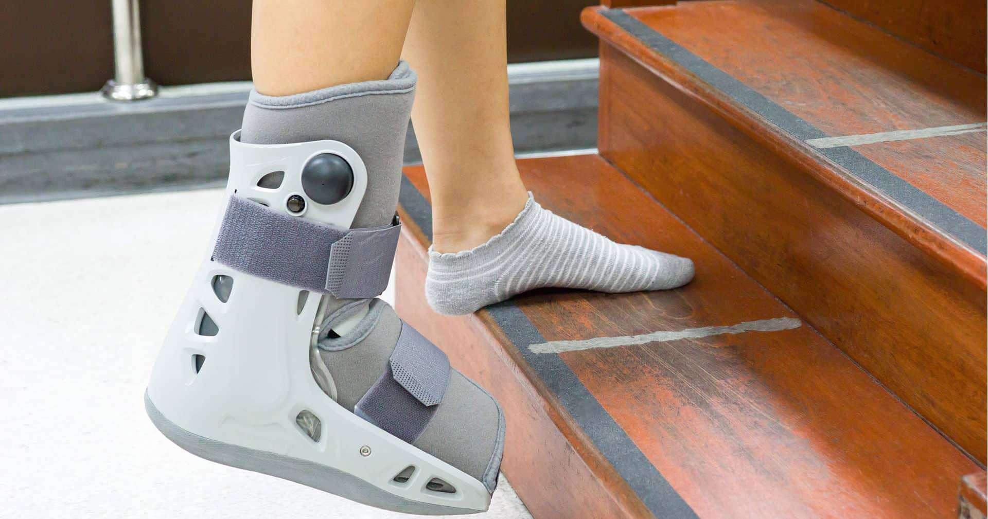 Physical Therapy Exercises For Stress Fracture In Foot At Don Pursel Blog