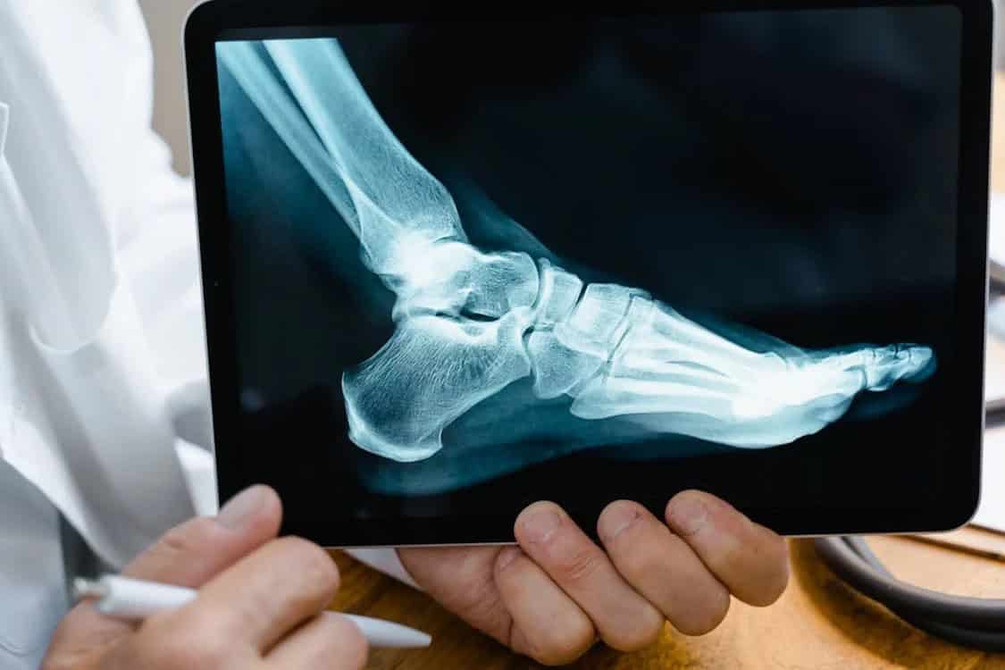 benefits of custom orthotics for foot pain The benefits of custom orthotics for foot pain