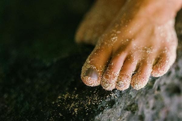Black toenail Black toenail