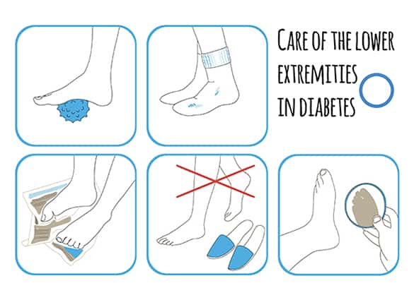 diabetes-feet-6 diabetes-feet-6