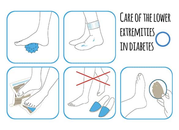 diabetes-feet-6