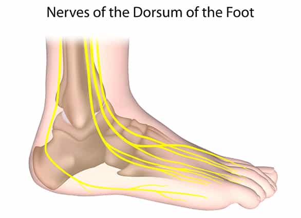 foot-Diabetic-Peripheral-Neuropathy-3