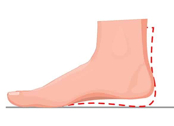 hallux-litmus-1 hallux-litmus-1