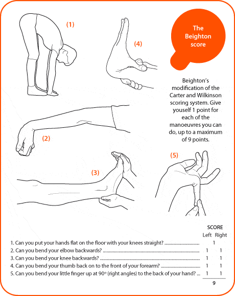 joint-hypermobility joint-hypermobility