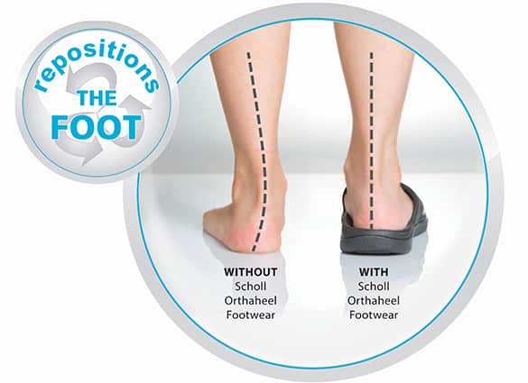 biomechanics orthaheel thongs