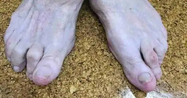 patient podiatry falls prevention