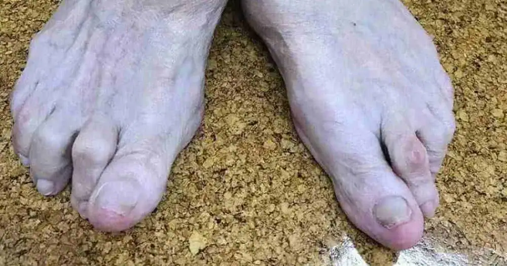 patient podiatry falls prevention