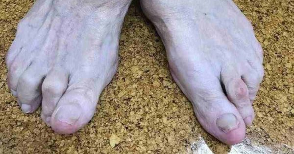 patient podiatry falls prevention
