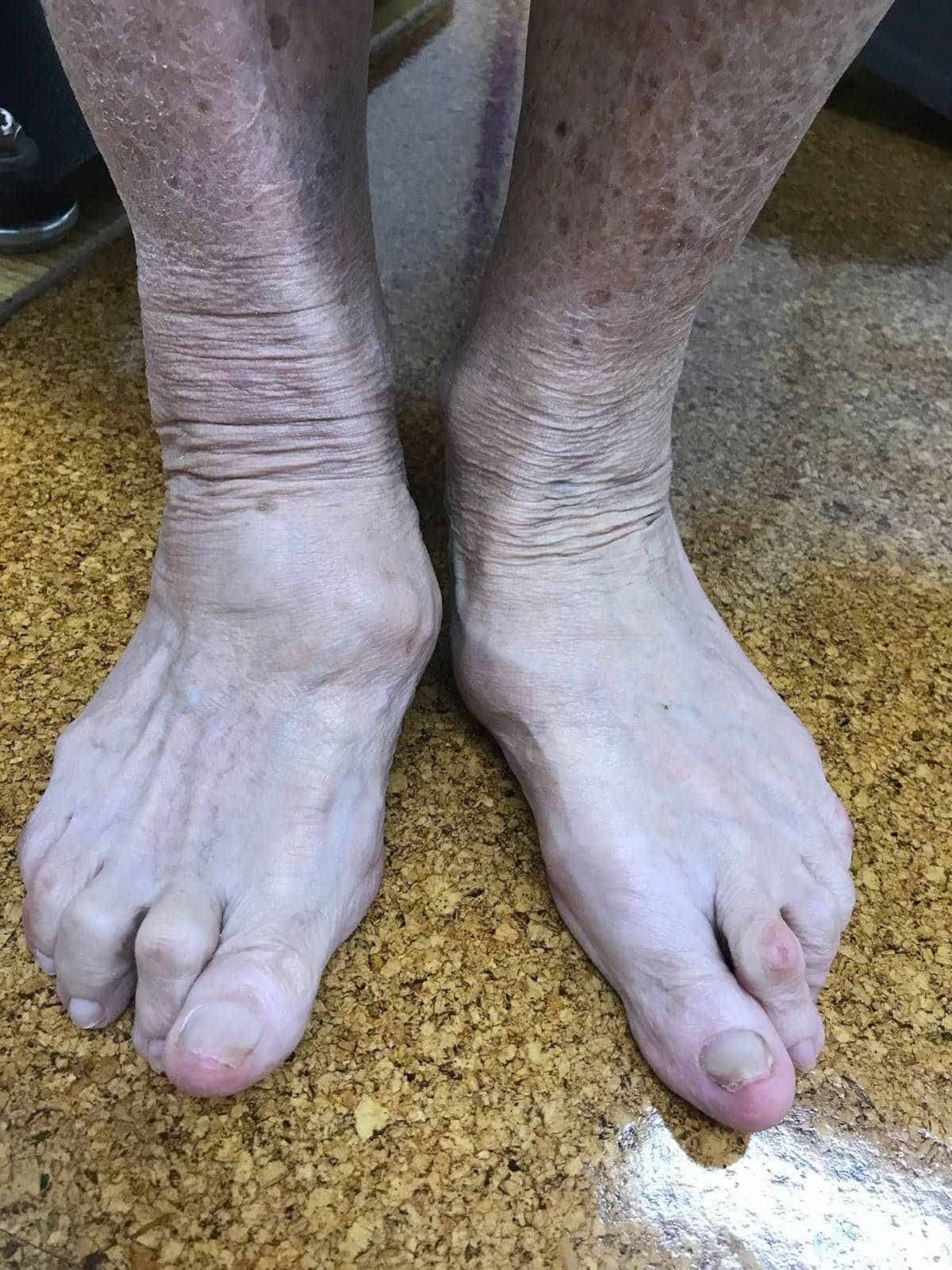 patient podiatry falls prevention patient podiatry falls prevention